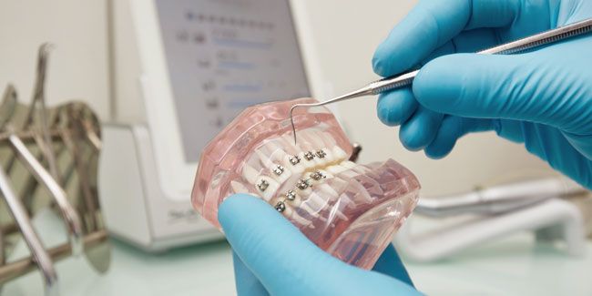 Élégance tardive : l'orthodontie pour les seniors, un nouveau sourire à tout âge