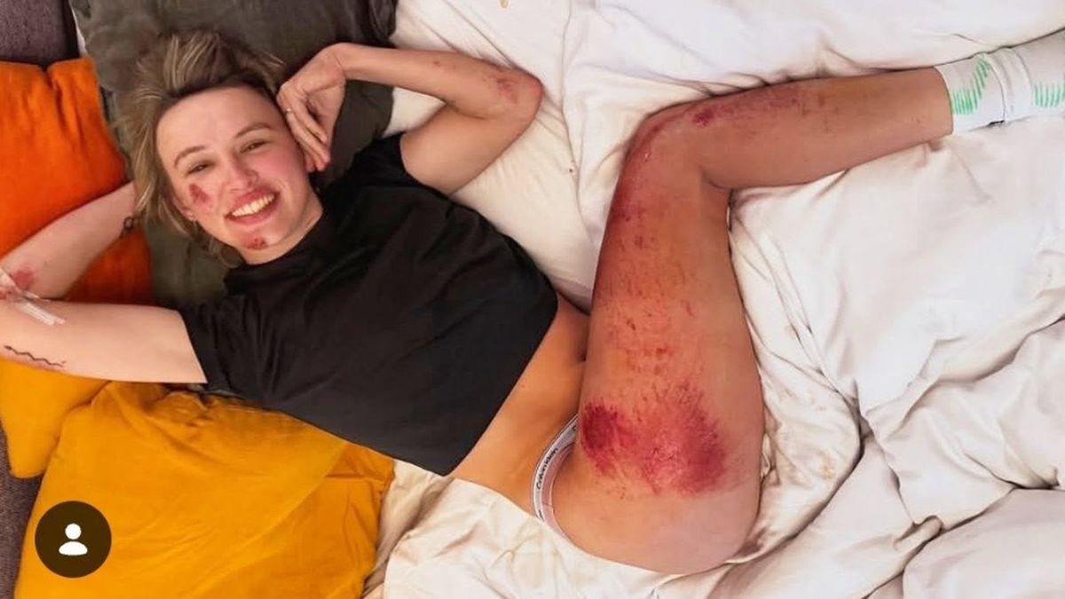 Milan San-Remo féminin : une chute spectaculaire soulève des inquiétudes